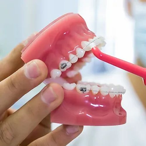 Odontología preventiva en la Clínica Dental Vidal Castellano, Las Palmas de Gran Canaria